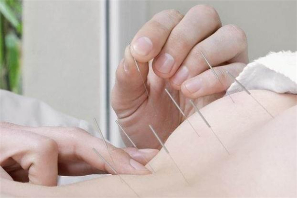 针灸减肥吗,针灸减肥到底有效吗