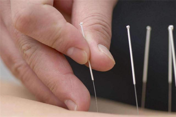 针灸减肥后多久可以吃主食,针灸减肥不能吃的东西