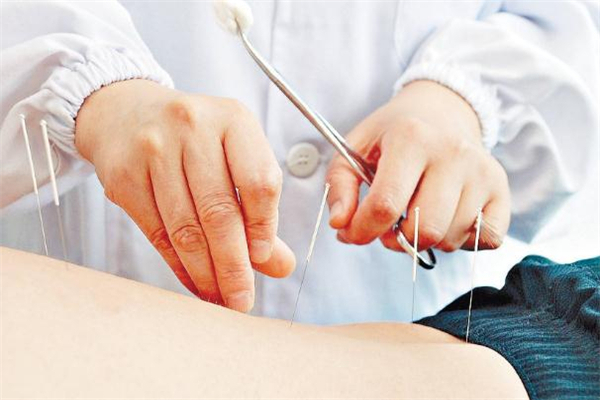 经期可以针灸减肥吗?,月经期可以针灸减肥吗