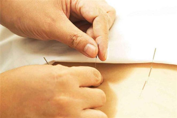 针灸减肥收费价目表,针灸减肥大概多少钱一次