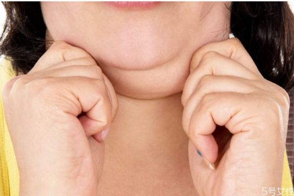 为什么会有双下巴应该怎么改善,怎么让双下巴消失