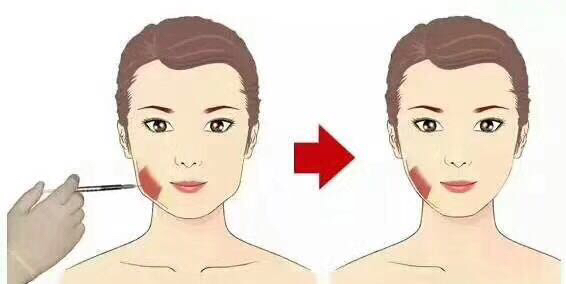 脸胖的原因有哪些,导致脸胖的原因