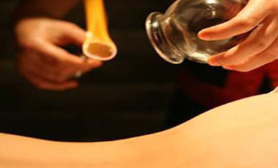 拔罐减肥可以天天拔吗,拔罐能减肥么