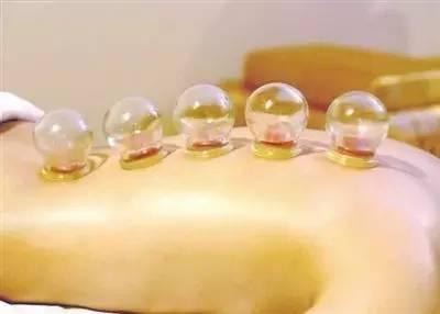 女人拔火罐的好处和坏处,女人拔火罐的好处和功效