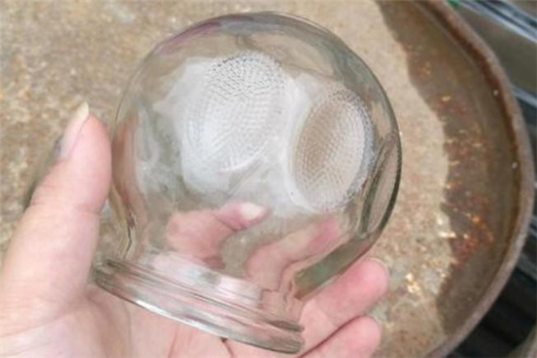 拔罐减肥需要忌口吗,拔罐到底能不能减肥