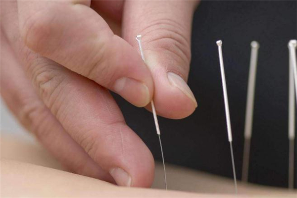 针灸减肥价格是多少,医院减肥针多少钱一针 针灸减肥价格是多少,医院减肥针多少钱一针