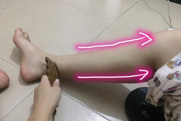 刮痧瘦腿能不能天天刮,刮痧真的可以瘦腿吗