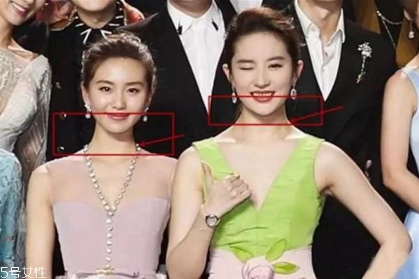 斜方肌是什么原因导致的,斜方肌是什么神经支配