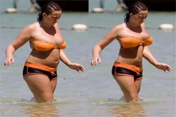 埋线减肥需要做几次,埋线减肥多久一次