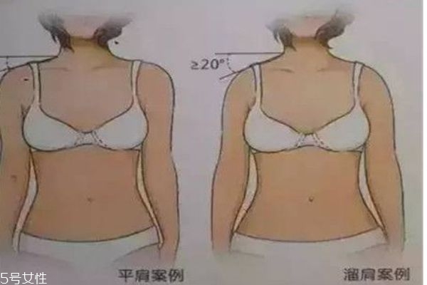 塌肩膀怎么矫正,斜肩怎么矫正