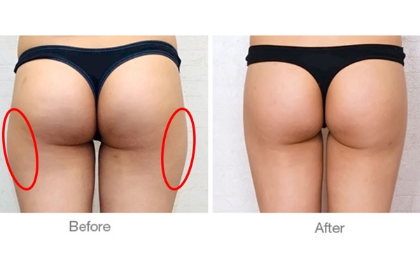 羊鞍肉是什么部位,马鞍在马的什么部位