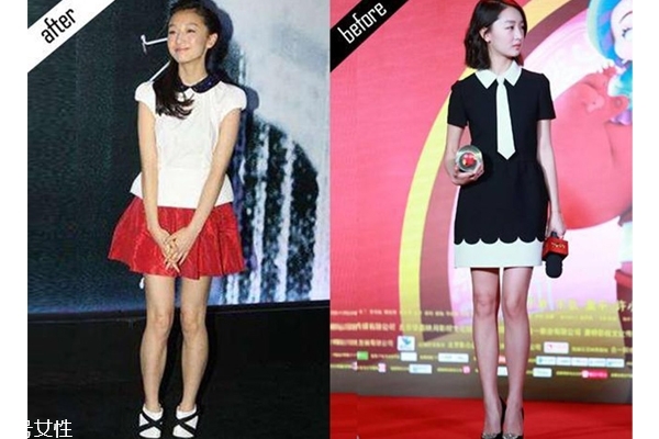 小腿外扩怎么矫正,小腿向外弯怎么矫正