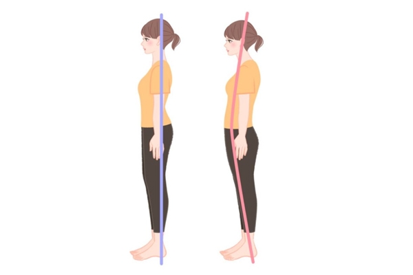 男生骨盆前倾怎么判断,胖人骨盆前倾怎么判断