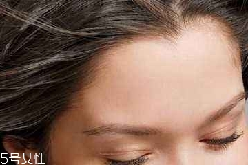 发际线后移怎么办能恢复吗,发际线往上移怎么办
