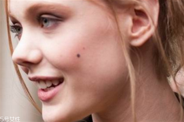点痣的危害,痣有什么坏处