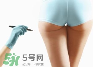 吸脂减肥副作用有哪些,吸脂减肥有用吗?