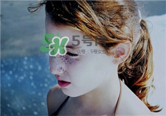 全脸脱毛有什么副作用,脸上脱毛有副作用吗