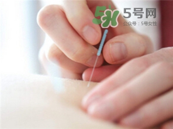 针灸减肥的弊端,针灸减肥的优缺点
