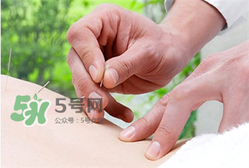 中医院针灸减肥,针灸减肥的原理及危害