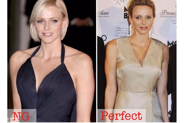 肩宽适合穿吊带吗,肩宽是穿细吊带还是宽 肩宽适合穿吊带吗,肩宽是穿细吊带还是宽