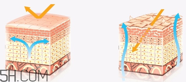 水杨酸可以去鸡皮吗,水杨酸软膏可以去鸡皮肤吗 水杨酸可以去鸡皮吗,水杨酸软膏可以去鸡皮肤吗