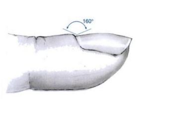 肝血不足指甲的症状是,肝功能异常手指甲的表现 肝血不足指甲的症状是,肝功能异常手指甲的表现