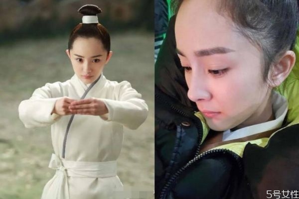 发际线后移如何预防,发际线后移有什么办法