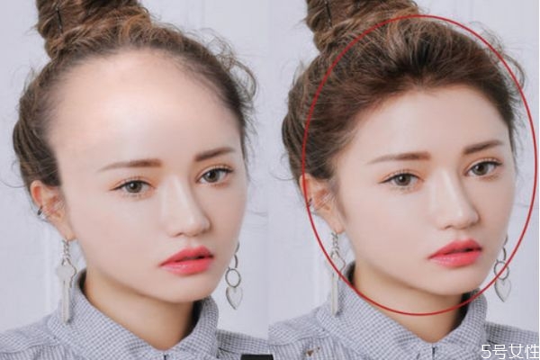 发际线为何会后移,发际线后移是为什么? 发际线为何会后移,发际线后移是为什么?