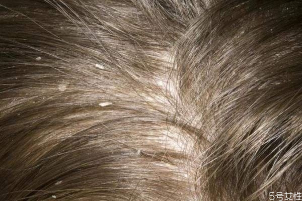 健康养生饮食,生活饮食健康小常识