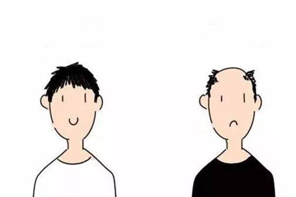 慢性脂溢性脱发怎么改善,溢脂性脱发怎么调理