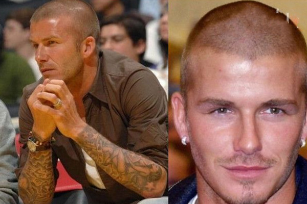 卡尺头型是什么样子的,卡尺头型最好几毫米