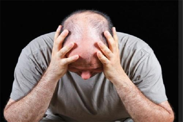 脱发怎么理发,头发护理能防止脱发吗