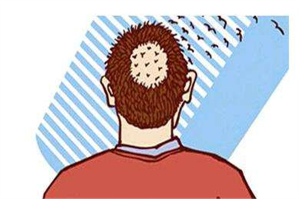 植发后需要注意些什么,植发以后注意事项