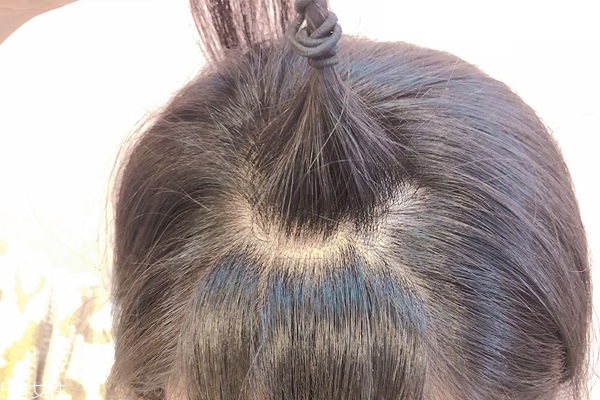 发量少如何扎马尾,发量少扎马尾简单好看的步骤