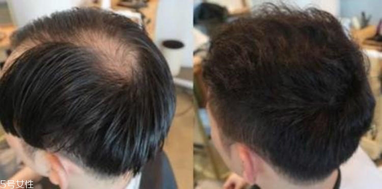 男生烫发有几种烫法图片,男生烫发有哪几种烫法