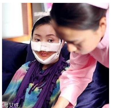 幻丑症表现,幻丑症测试