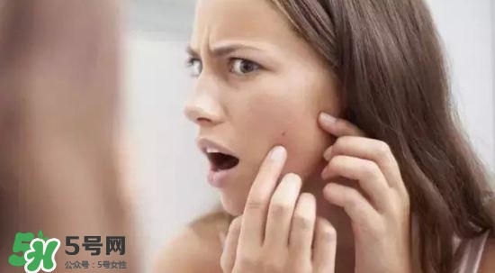 怎么去痘印最有效的方法,怎么去痘印痘坑