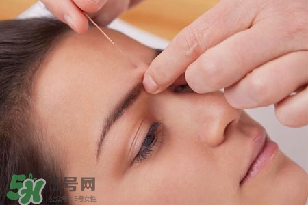 哪些人不适合针灸(哪些人不适合针灸治疗)