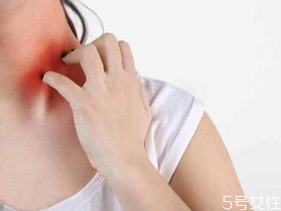 荨麻疹发出来是排毒吗急性荨麻疹,发荨麻疹是在排毒吗 荨麻疹发出来是排毒吗急性荨麻疹,发荨麻疹是在排毒吗