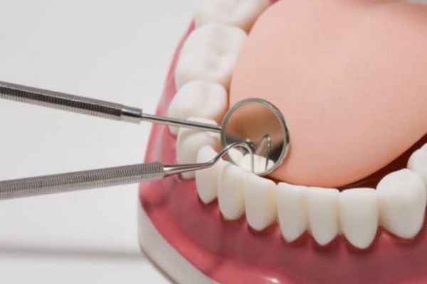 如何解决牙齿发黄,牙齿发黄有什么办法