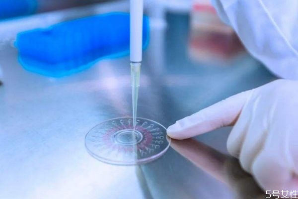 核酸检测的价格及出结果的时间,核酸检测的价格会不一样嘛