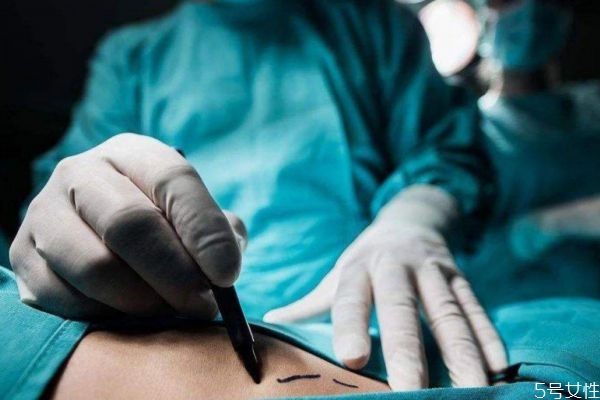 败血病什么原因引起,什么叫败血病