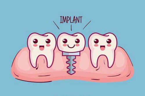 种植牙伤口多久愈合,种植牙齿多久能恢复?