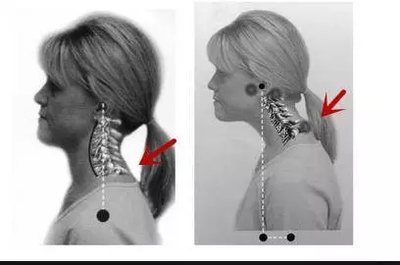 富贵包要注意些什么,怎么避免长富贵包