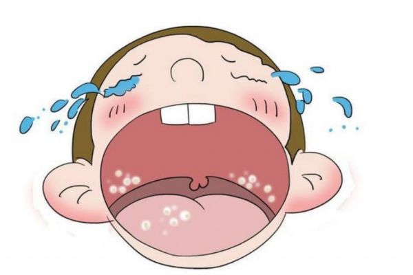 鹅口疮危害大吗,鹅口疮的危害大不大