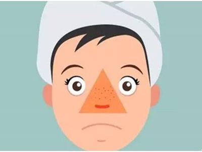 痤疮都有什么症状,是什么引起的痤疮 痤疮都有什么症状,是什么引起的痤疮