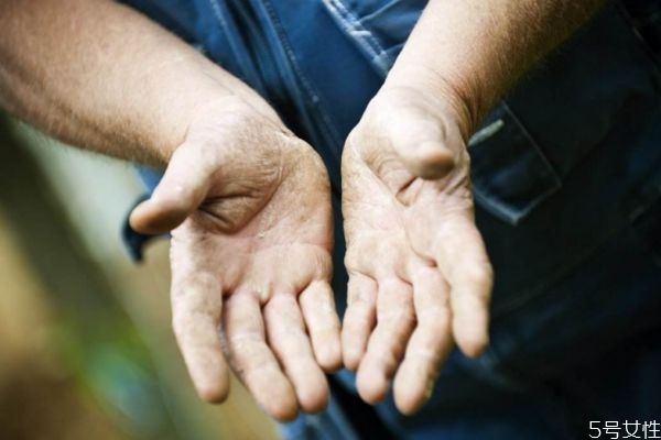 手麻脚麻什么原因,手脚总是发麻是怎么回事