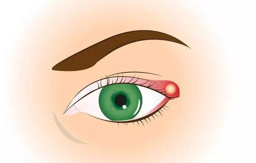 针眼切开排脓几天能好,针眼去医院排脓会痛吗 针眼切开排脓几天能好,针眼去医院排脓会痛吗
