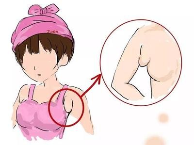 怎么知道自己有没有副乳,怎么判断自己有没有副乳 怎么知道自己有没有副乳,怎么判断自己有没有副乳