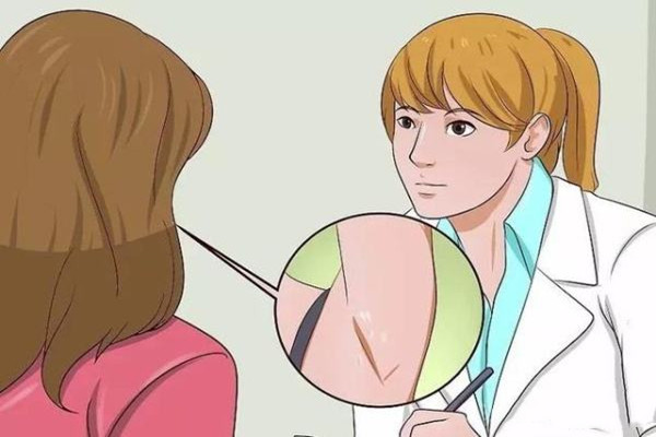 怎么预防狐臭发生,狐臭怎么形成 怎么避免 怎么预防狐臭发生,狐臭怎么形成 怎么避免